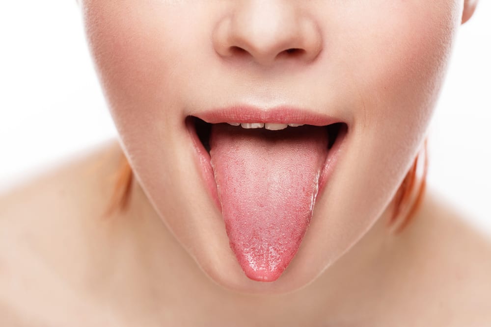 Most Extreme Ways People Try to Stay Skinny - Tongue Patch